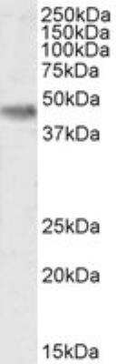 Western Blot: Casein Kinase 1 delta Antibody [NB100-2919]