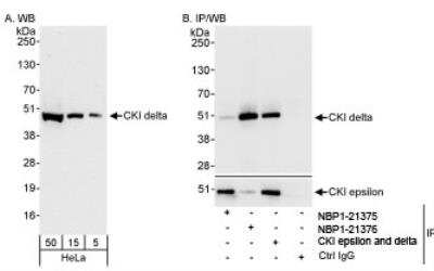 Western Blot: Casein Kinase 1 delta Antibody [NBP1-21376]