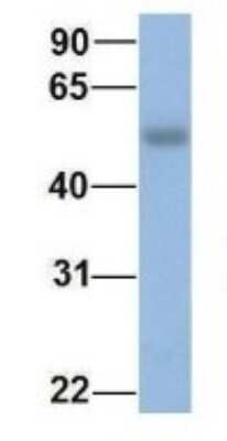 Western Blot: Casein Kinase 1 delta Antibody [NBP1-52975]