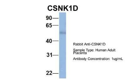 Western Blot: Casein Kinase 1 delta Antibody [NBP1-52975]