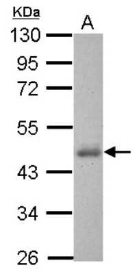 Western Blot: Casein Kinase 1 delta Antibody [NBP2-15708]