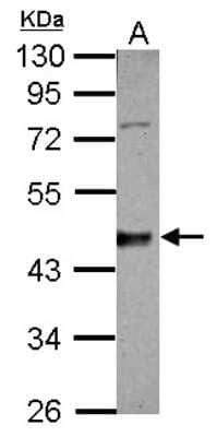 Western Blot: Casein Kinase 1 delta Antibody [NBP2-15708]