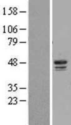 Western Blot: Casein Kinase 1 delta Overexpression Lysate [NBL1-09529]