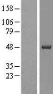 Western Blot: Casein Kinase 1 delta Overexpression Lysate [NBL1-09530]