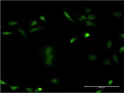 Immunocytochemistry/ Immunofluorescence: Casein Kinase 1 epsilon Antibody (2E1) [H00001454-M07]