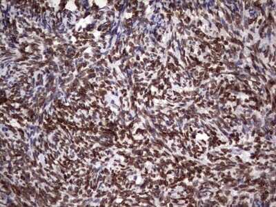 Immunohistochemistry: Casein Kinase 1 epsilon Antibody (OTI5D4) [NBP2-46377]