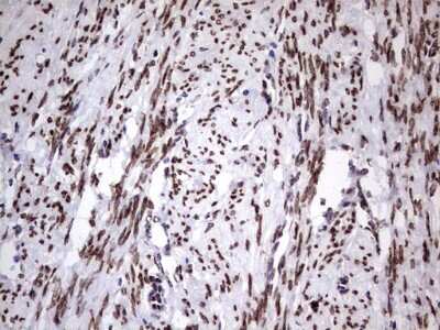 Immunohistochemistry: Casein Kinase 1 epsilon Antibody (OTI5D4) [NBP2-46377]
