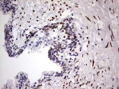 Immunohistochemistry: Casein Kinase 1 epsilon Antibody (OTI5D4) [NBP2-46377]
