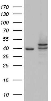 Western Blot: Casein Kinase 1 epsilon Antibody (OTI5D4) [NBP2-46377]