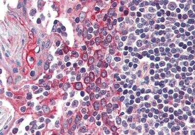 Immunohistochemistry-Paraffin: Casein Kinase 1 epsilon Antibody [NB100-93388]