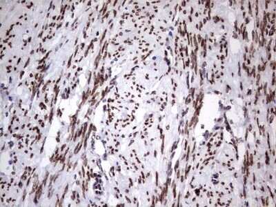 Immunohistochemistry: Casein Kinase 1 epsilon Antibody (OTI5D4) - Azide and BSA Free [NBP2-70464]