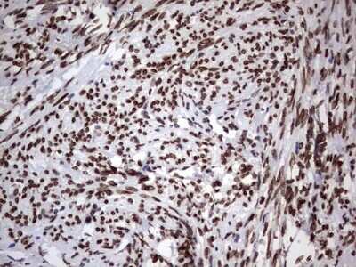 Immunohistochemistry: Casein Kinase 1 epsilon Antibody (OTI5D4) - Azide and BSA Free [NBP2-70464]
