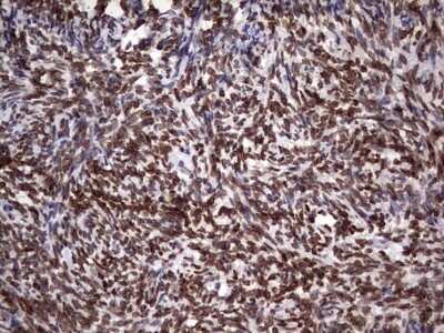 Immunohistochemistry: Casein Kinase 1 epsilon Antibody (OTI5D4) - Azide and BSA Free [NBP2-70464]