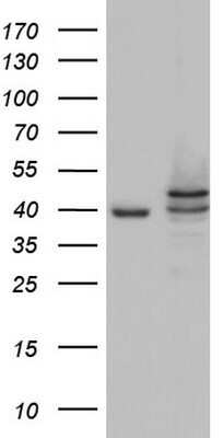 Western Blot: Casein Kinase 1 epsilon Antibody (OTI5D4)Azide and BSA Free [NBP2-70464]