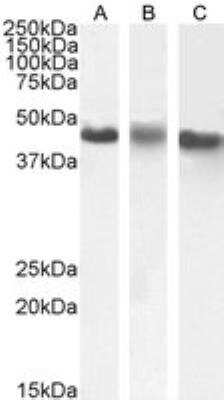 Western Blot: Casein Kinase 1 epsilon Antibody [NB100-93388]