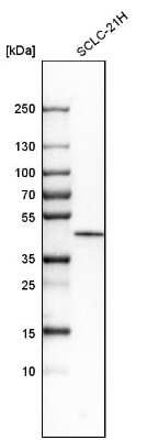 Western Blot: Casein Kinase 1 epsilon Antibody [NBP1-89712]