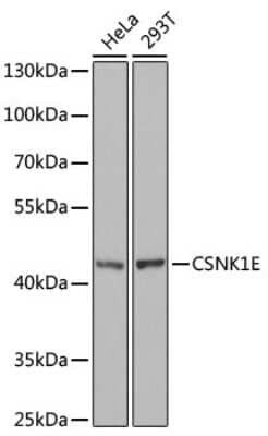 Western Blot: Casein Kinase 1 epsilon AntibodyBSA Free [NBP2-92968]