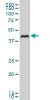 Western Blot: Casein Kinase 1 gamma 2 Antibody (2E6) [H00001455-M02]