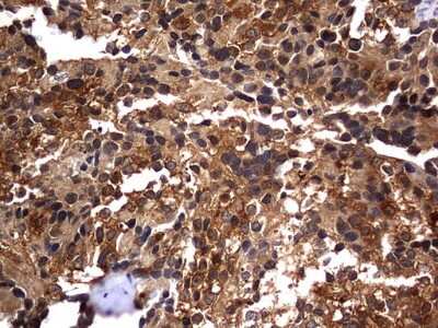 Immunohistochemistry: Casein Kinase 1 gamma 2 Antibody (OTI4H3) [NBP2-46385]