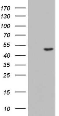 Western Blot: Casein Kinase 1 gamma 2 Antibody (OTI4H3) [NBP2-46385]