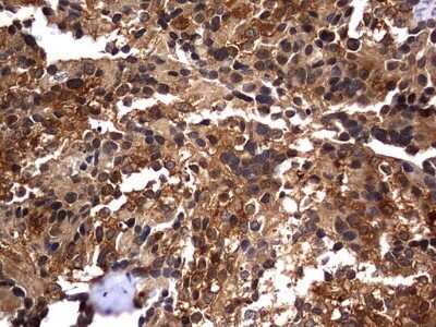Immunohistochemistry: Casein Kinase 1 gamma 2 Antibody (OTI4H3) - Azide and BSA Free [NBP2-70465]