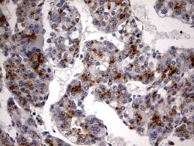 Immunohistochemistry: Casein Kinase 1 gamma 2 Antibody (OTI4H3) - Azide and BSA Free [NBP2-70465]
