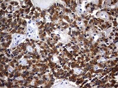 Immunohistochemistry: Casein Kinase 1 gamma 2 Antibody (OTI4H3) - Azide and BSA Free [NBP2-70465]