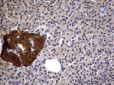 Immunohistochemistry: Casein Kinase 1 gamma 2 Antibody (OTI4H3) - Azide and BSA Free [NBP2-70465]