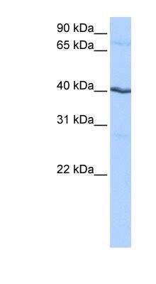 Western Blot: Casein Kinase 1 gamma 2 Antibody [NBP1-56550]