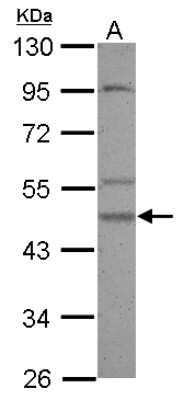 Western Blot: Casein Kinase 1 gamma 2 Antibody [NBP2-15709]