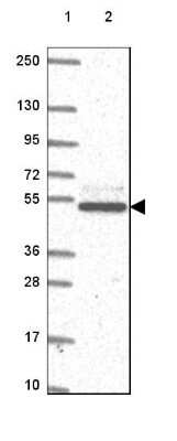 Western Blot: Casein Kinase 1 gamma 2 Antibody [NBP2-49232]