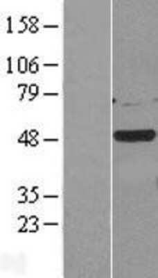 Western Blot: Casein Kinase 1 gamma 2 Overexpression Lysate [NBL1-09533]