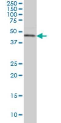 Western Blot: Casein Kinase 1 gamma Antibody (2E10) [H00053944-M02]