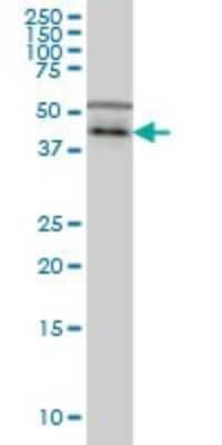 Western Blot: Casein Kinase 1 gamma Antibody (3D1) [H00053944-M01]