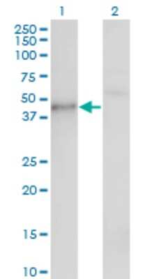 Western Blot: Casein Kinase 1 gamma Antibody (3D1) [H00053944-M01]
