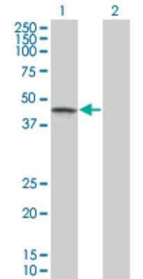 Western Blot: Casein Kinase 1 gamma Antibody (3F10) [H00053944-M03]