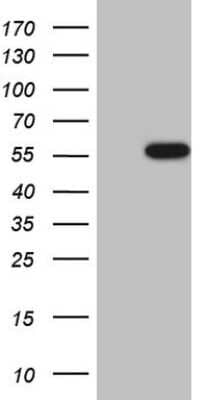 Western Blot: Casein Kinase 1 gamma Antibody (OTI4D9) [NBP2-46384]