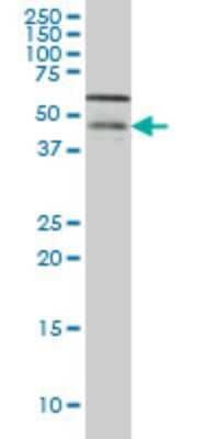 Western Blot: Casein Kinase 1 gamma Antibody (8A4) [H00053944-M04]