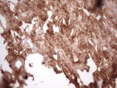 Immunohistochemistry: Casein Kinase 1 gamma Antibody (OTI4D9) - Azide and BSA Free [NBP2-71948]