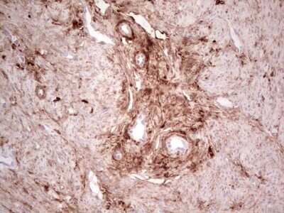 Immunohistochemistry: Casein Kinase 1 gamma Antibody (OTI4D9) - Azide and BSA Free [NBP2-71948]
