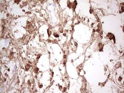 Immunohistochemistry: Casein Kinase 1 gamma Antibody (OTI4D9) - Azide and BSA Free [NBP2-71948]