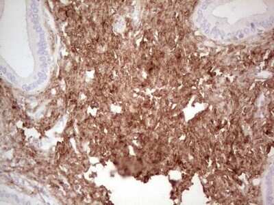 Immunohistochemistry: Casein Kinase 1 gamma Antibody (OTI4D9) - Azide and BSA Free [NBP2-71948]