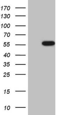 Western Blot: Casein Kinase 1 gamma Antibody (OTI4D9)Azide and BSA Free [NBP2-71948]