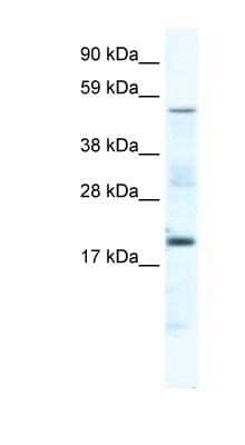 Western Blot: Casein Kinase 1 gamma Antibody [NBP1-80262]