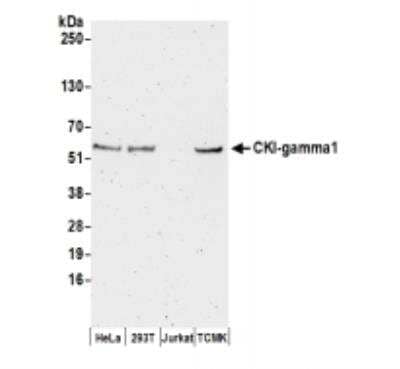 Western Blot: Casein Kinase 1 gamma Antibody [NBP2-32245]