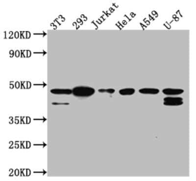 Western Blot: Casein Kinase 2 alpha Antibody (2B6) [NBP3-15160]