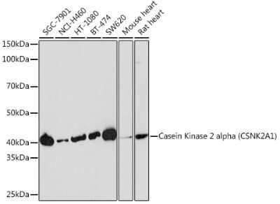 Western Blot: Casein Kinase 2 alpha Antibody (2P3M7) [NBP3-15858]