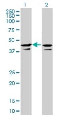 Western Blot: Casein Kinase 2 alpha Antibody (3D9) [H00001457-M01]