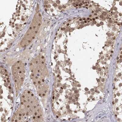 Immunohistochemistry-Paraffin: Casein Kinase 2 alpha Antibody [NBP2-68778]