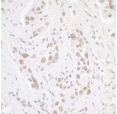 Immunohistochemistry-Paraffin: Casein Kinase 2 alpha Antibody [NB100-377]